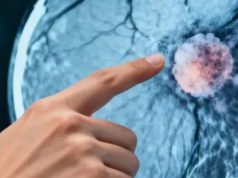 This lymph node is the first to detect if cancer is spreading